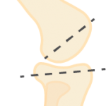 Knee Slope diagram