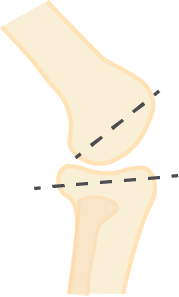 knee slope Knee Slope diagram