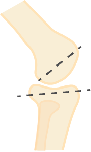 Knee Slope diagram