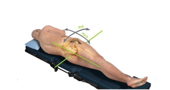 A diagram of patient laying on a bed to show the degrees and direction of movement.