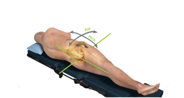 A diagram of patient laying on a bed to show the degrees and direction of movement.