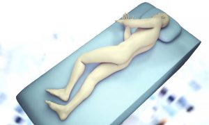 3D illustration showing a patient lying on their side