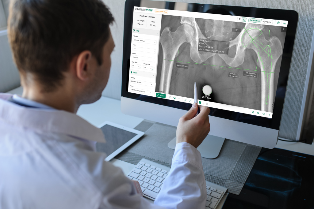 Surgeon using Intellijoint VIEW for planning