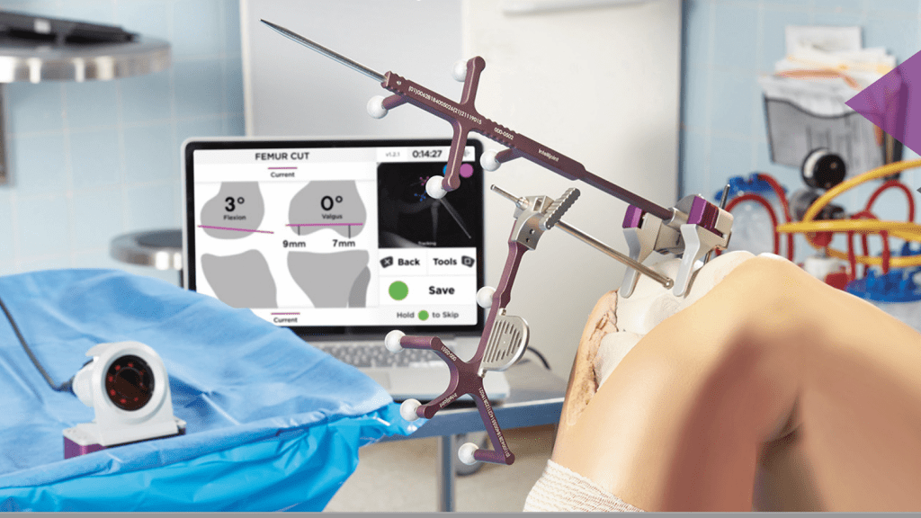 Intellijoint KNEE navigation system showing new rotation feature