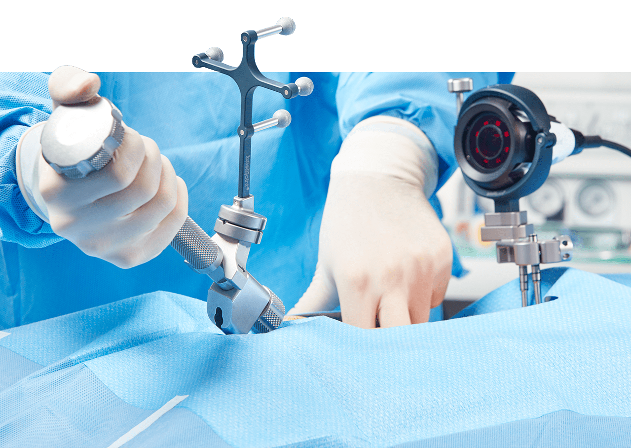 Intellijoint Surgical HIP Navigation Tool