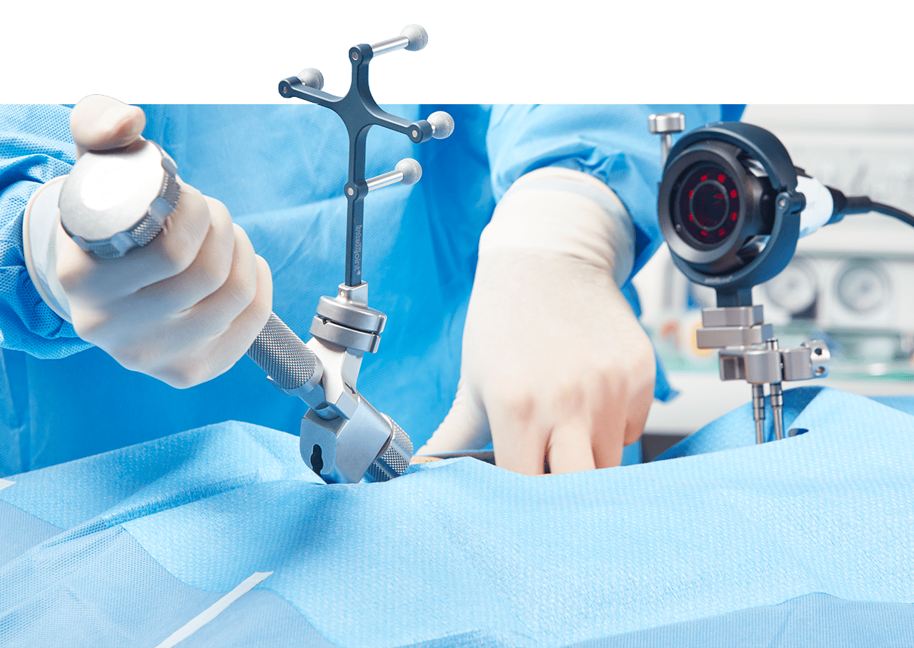 Intellijoint Surgical HIP Navigation Tool Intellijoint Surgical HIP Navigation Tool