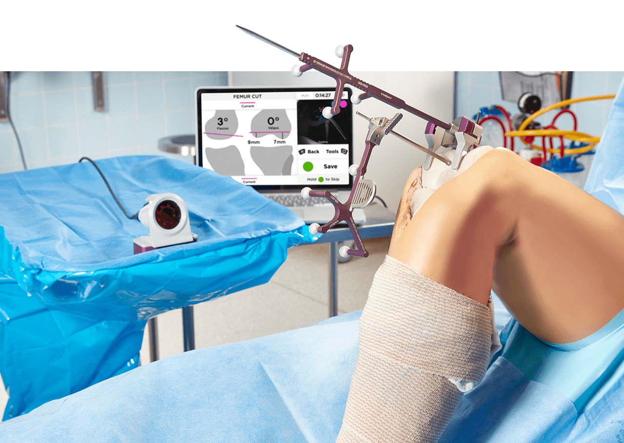 Operating room with Intellijoint KNEE camera, software and device set up with artificial knee