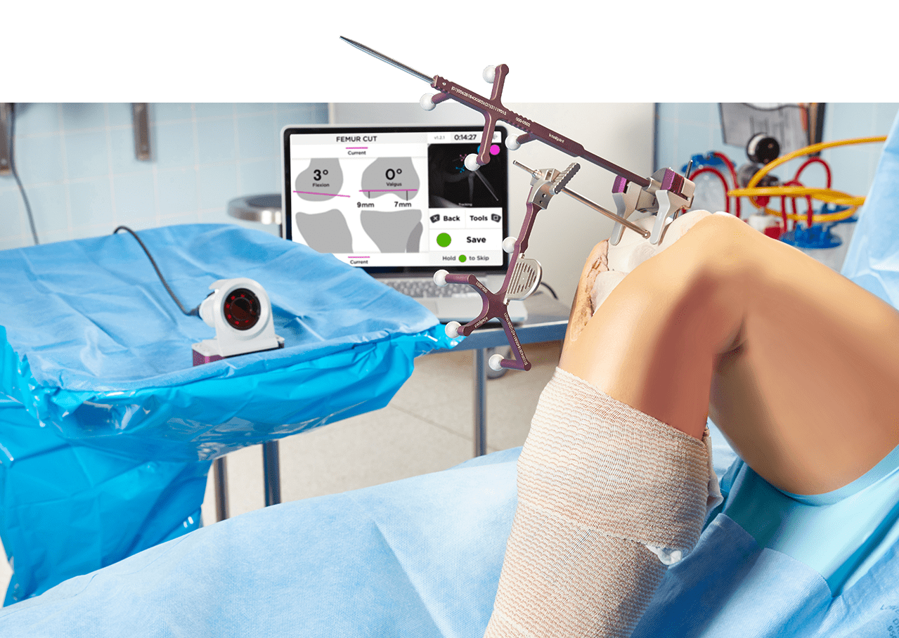 Intellijoint Surgical KNEE Navigation Tool Operating room with Intellijoint KNEE camera, software and device set up with artificial knee