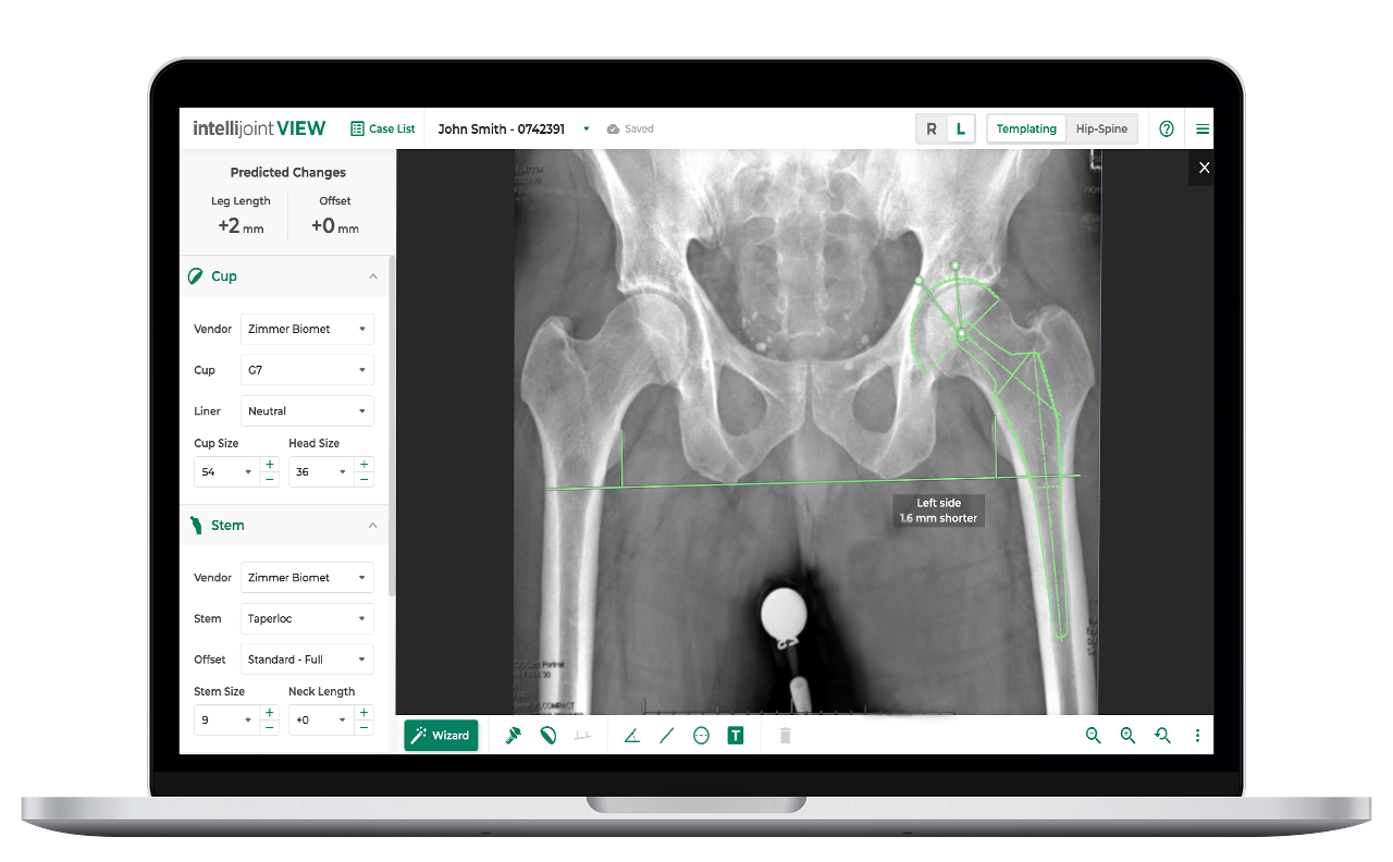 VIEW Image - Screenshot of templating Screenshot of templating screen on VIEW platform