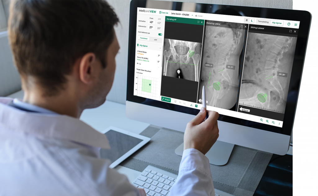 Doctor looking at a computer screen with Intellijoint VIEW hip-spine analysis screen