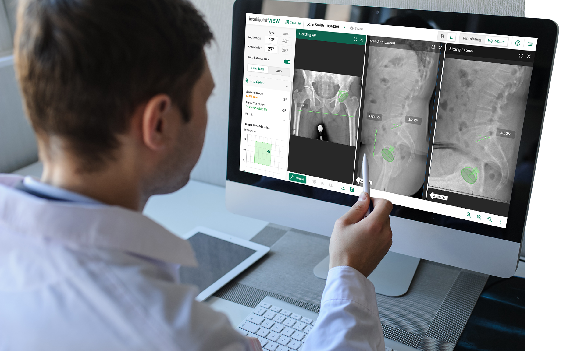 Doctor looking at a computer screen with Intellijoint VIEW hip-spine analysis screen