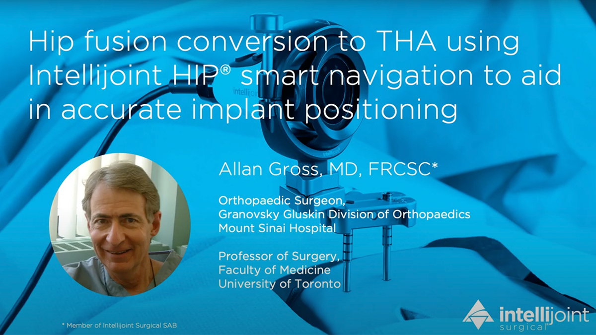 Title slide of live surgery video for accurate implant positioning