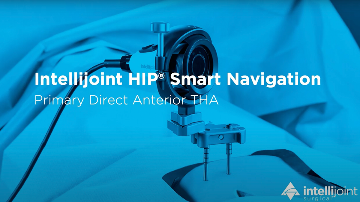 Title slide of Intellijoint HIP Smart Navigation live surgery video