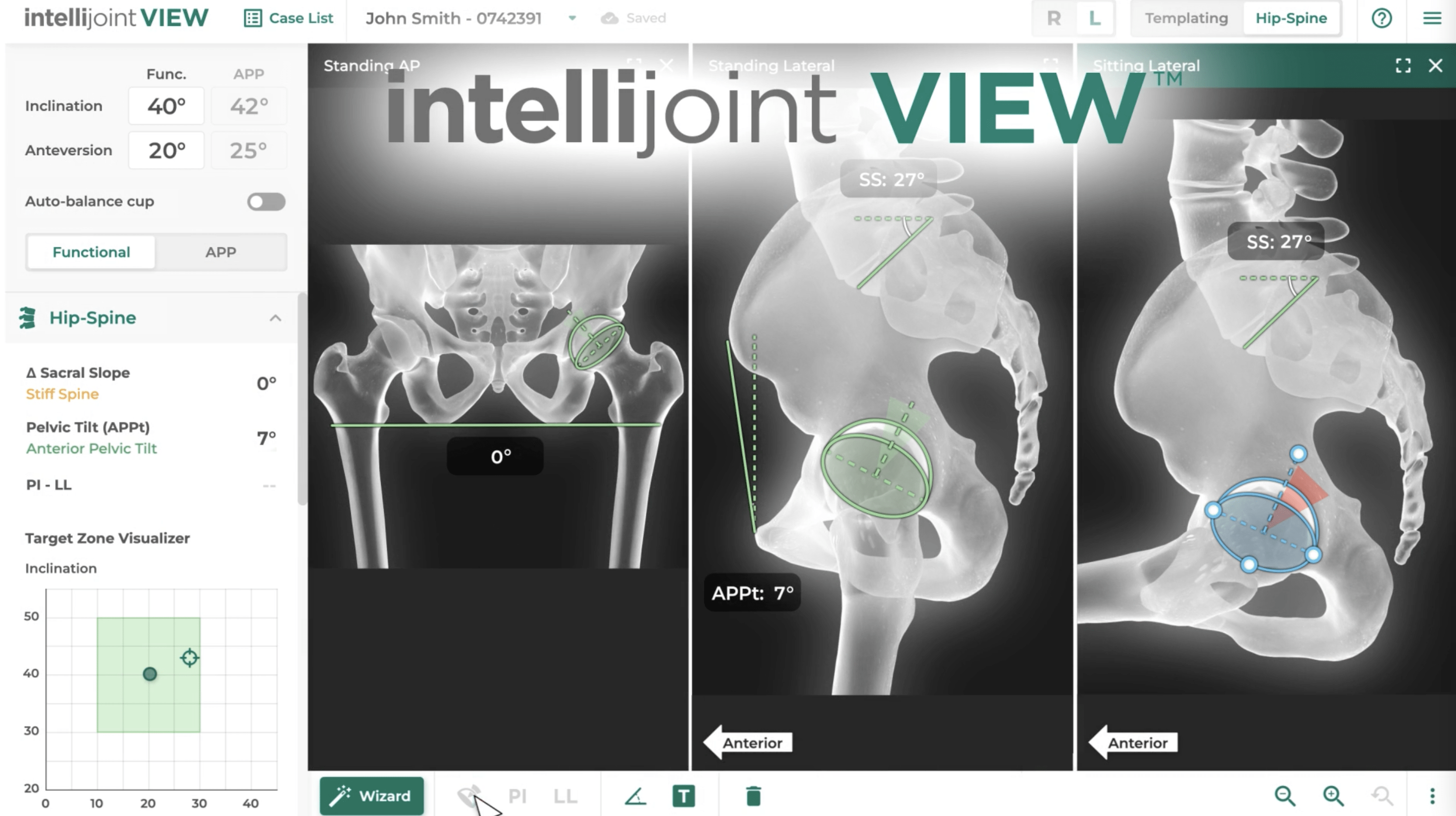 Screen of web-based surgical platform showing 3 x-rays of different pelvic views