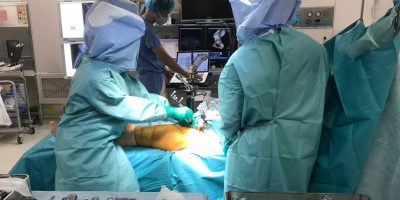 The first THA using Intellijoint HIP in Japan