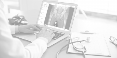 Doctor looking at a laptop with the Intellijoint VIEW screen on it
