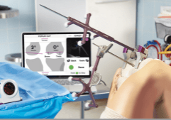 Intellijoint KNEE navigation system showing new rotation feature