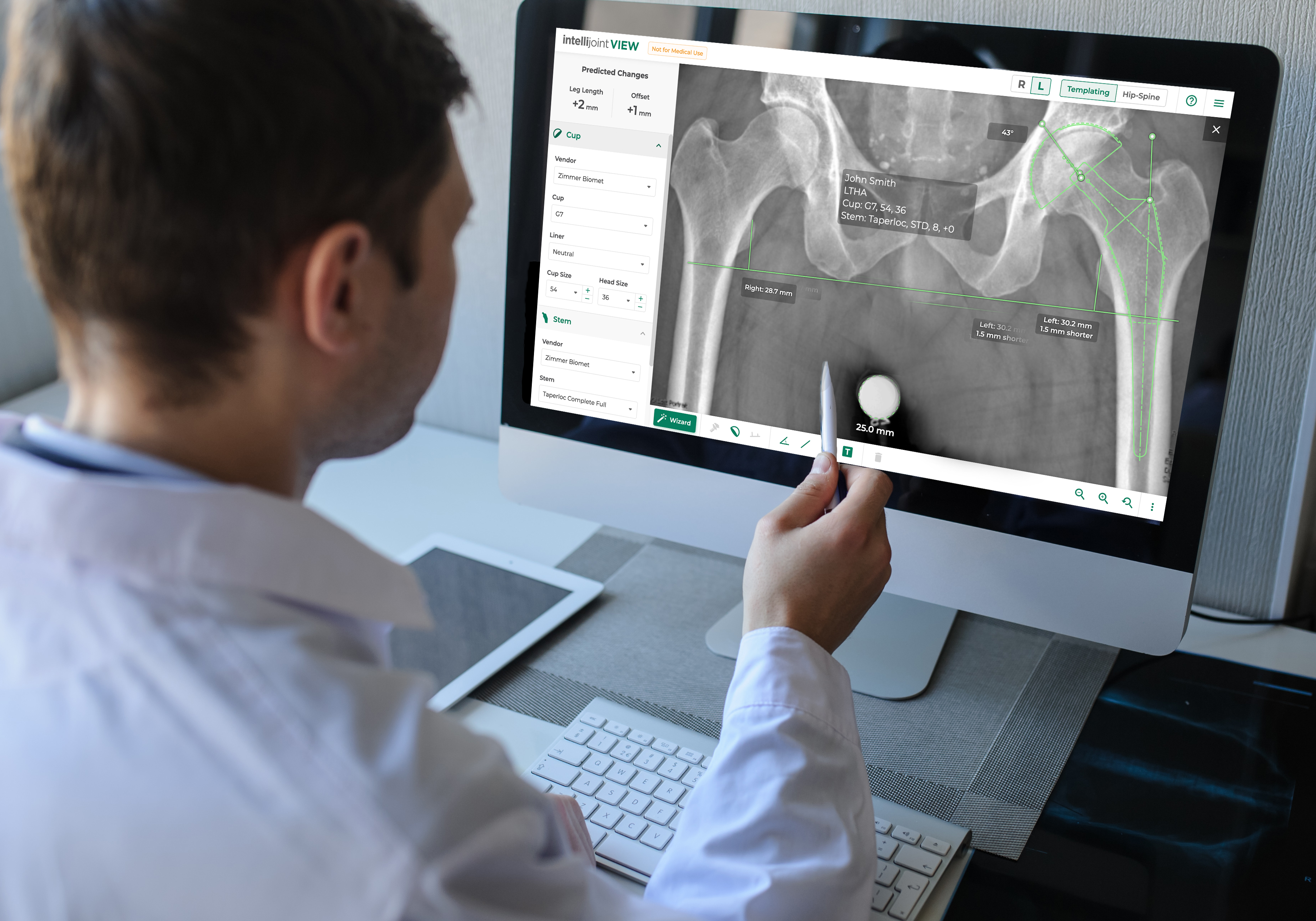 Surgeon using Intellijoint VIEW for planning