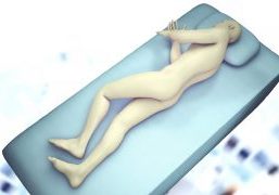 3D illustration showing a patient lying on their side